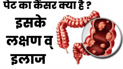 पेट के कैंसर से बचाव