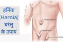 हर्निया के कारण और उपाय