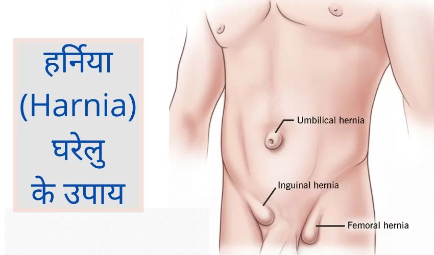 हर्निया के कारण और उपाय